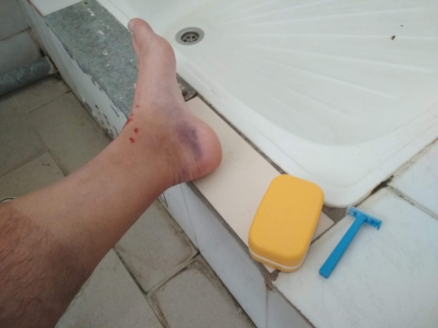 Нога.jpg Нога.jpg