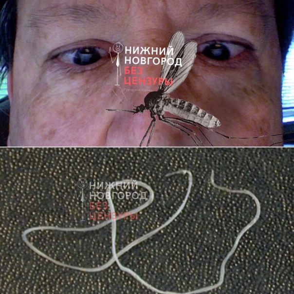 Черви-1.jpg Черви-1.jpg