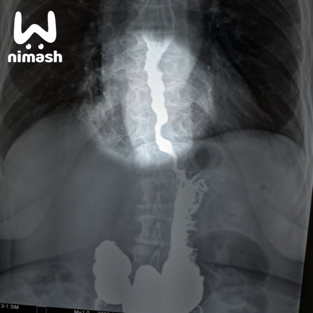 Надули-1.jpg Надули-1.jpg