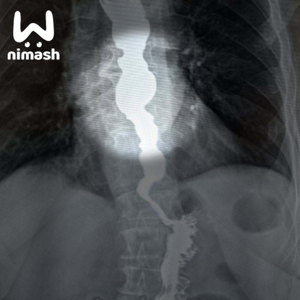 Надули-2.jpg Надули-2.jpg